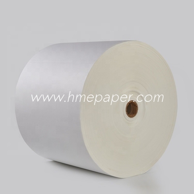 comprar Paciente plissado médico do Tracheostomy do papel de filtro do Spirometry do papel de filtro de HME online manufacture